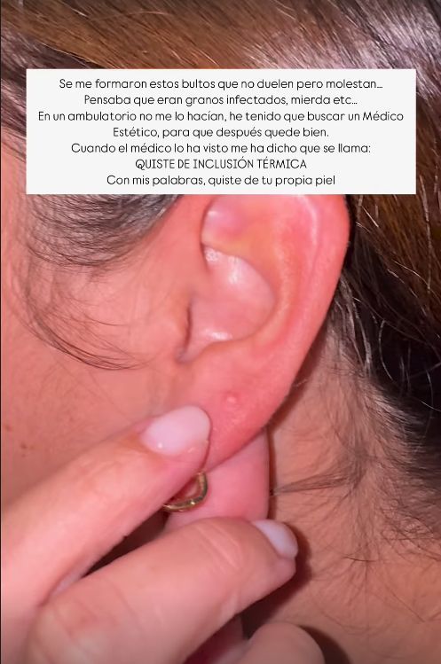 Anabel Pantoja announces that it has been surgically intervened