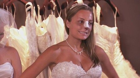 Bridalplasty
