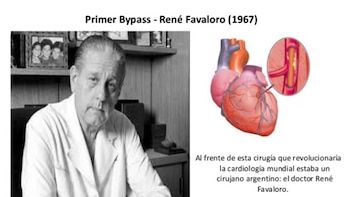 The first bypass was made