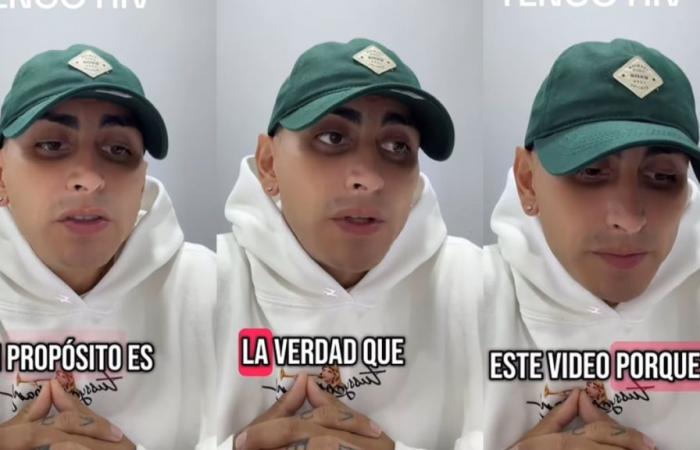 Famous singer revealed that he has HIV: “I had a past of excess alcohol, drugs, sex …”