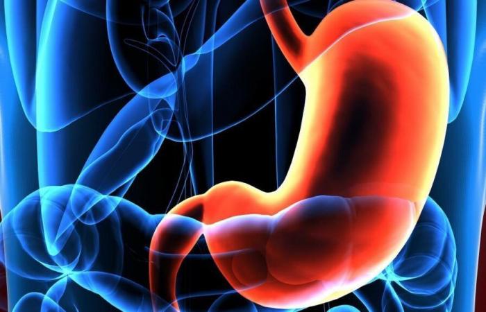 An asymptomatic tumor that is related to the pylori helicobácter