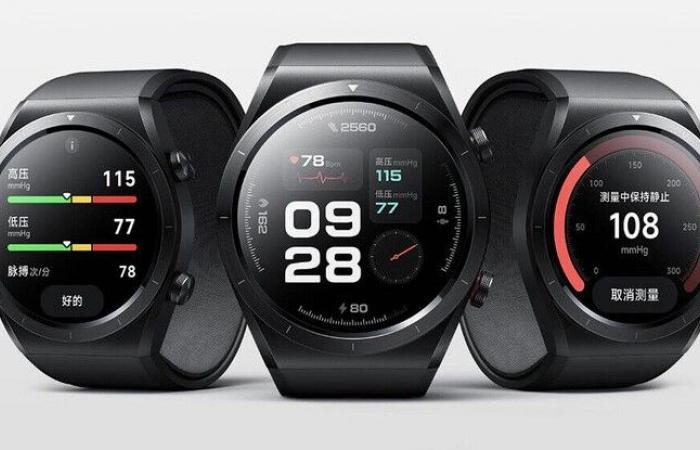 Next-gen Xiaomi Watch appears with monster battery upgrade and eSIM in new leak