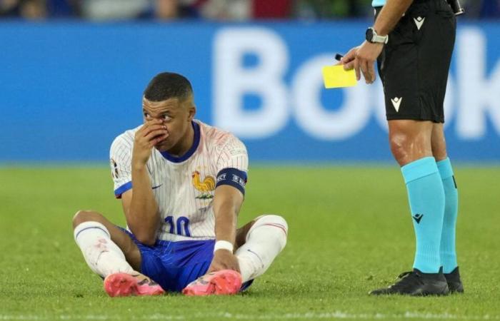 Suffering: Mbappé leaves with a blow to the nose and France defeats Austria in the Euro