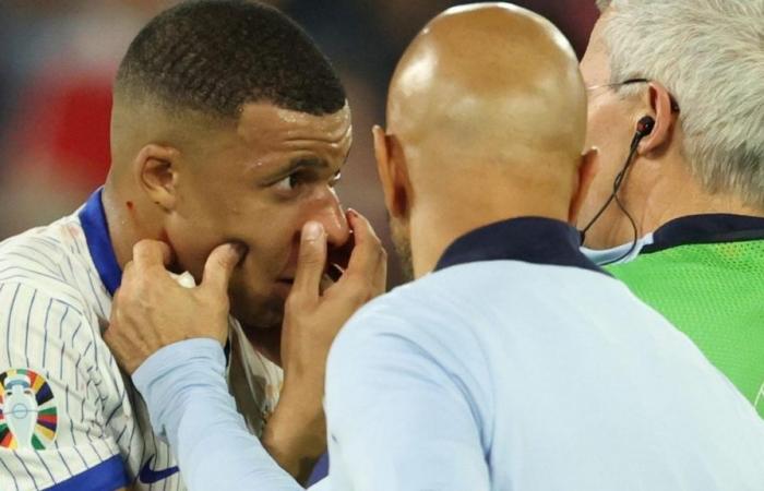The decision of Mbappé and the doctors of the French National Team after his nose fracture