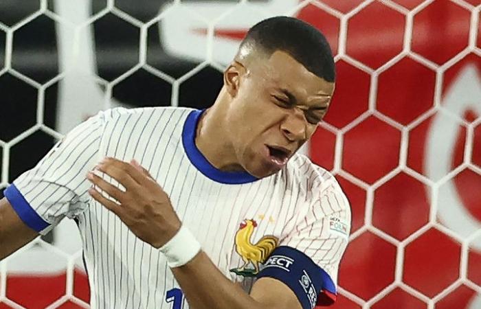Mbappé suffered a tremendous blow, with a fracture :: Olé