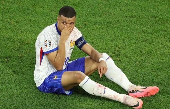 Mbappé suffered a tremendous blow, with a fracture :: Olé