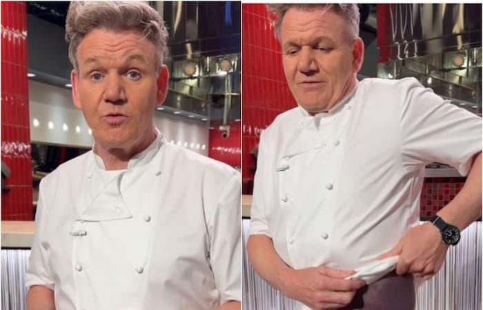 Gordon Ramsay showed the consequences after suffering a serious bicycle accident