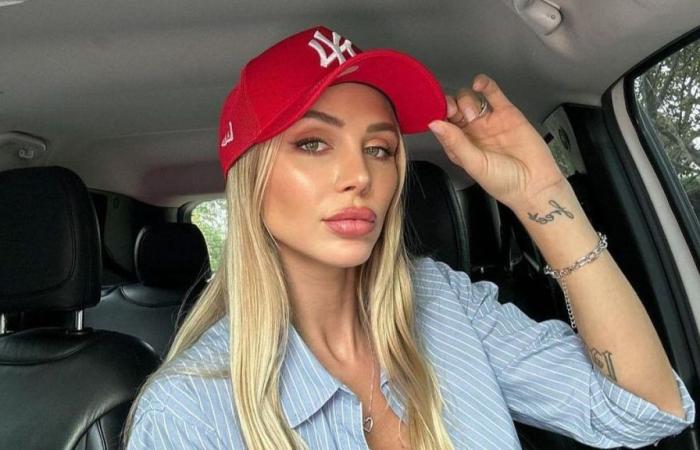 Romina Malaspina’s drama after a substance that ruined her lips: Don’t do it to her
