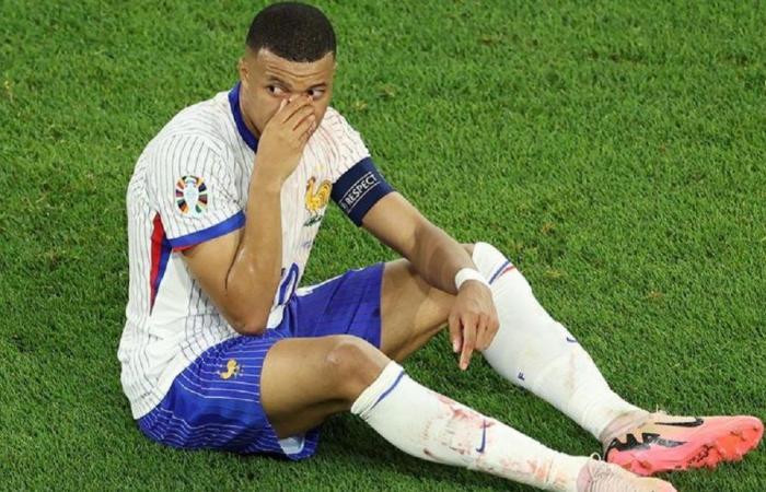 After Kylian Mbappé’s septum fracture, a doctor warned that he needs six weeks for healing