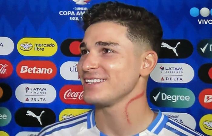 What happened to Julián Álvarez’s neck in the victory of the Argentine National Team against Canada for the Copa América 2024