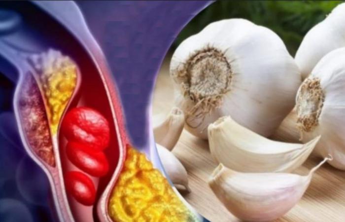 How to consume garlic to lower cholesterol and blood sugar