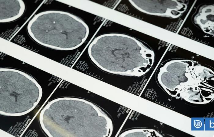 They detect 6 different types of depression after scanning 800 brains