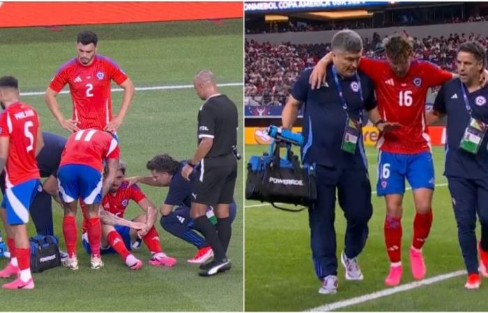 Diego Valdés and Igor Lichnovsky injured in Chile against Peru