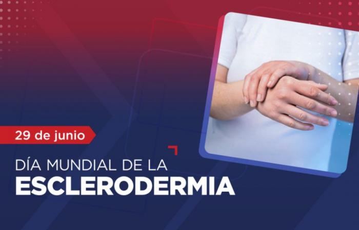 Scleroderma is a rheumatic condition that mostly affects women.