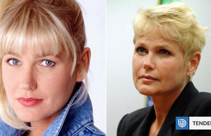 They say that Xuxa had 80 cosmetic procedures done in 7 hours
