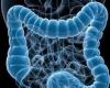 A cocktail of antibiotics, probiotics and prebiotics shows results in irritable bowel syndrome